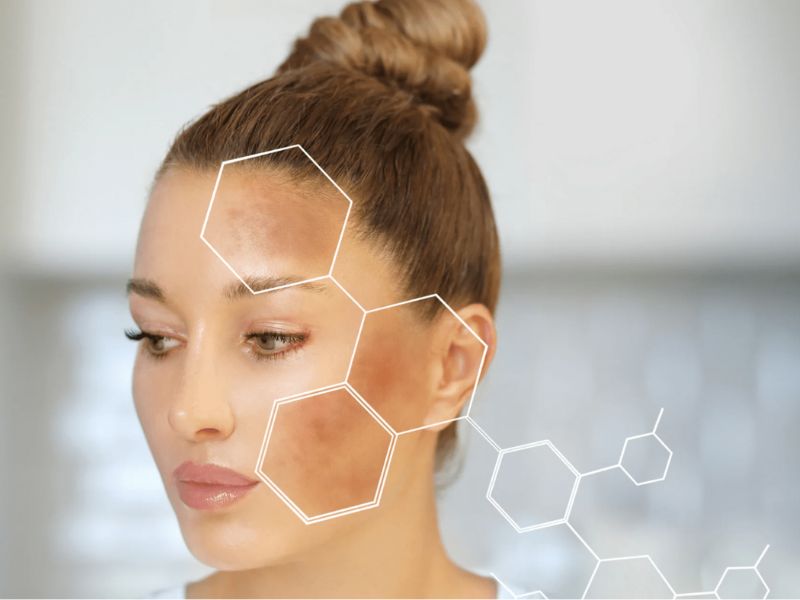 Cải thiện sắc tố da và giảm đốm nâu cũng là công dụng làm đẹp của ATP
