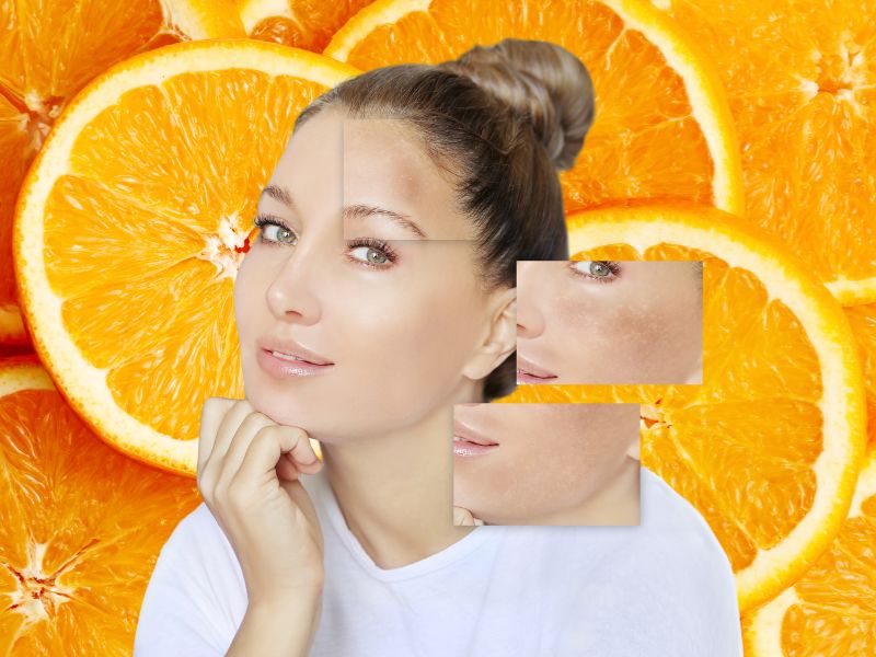 Vitamin C hỗ trợ làm sáng da và đều màu da hiệu quả