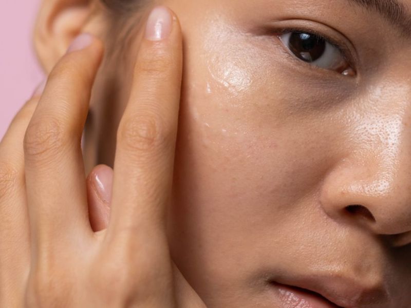 Tràm trà thường được sử dụng để hỗ trợ trong quá trình loại bỏ mụn