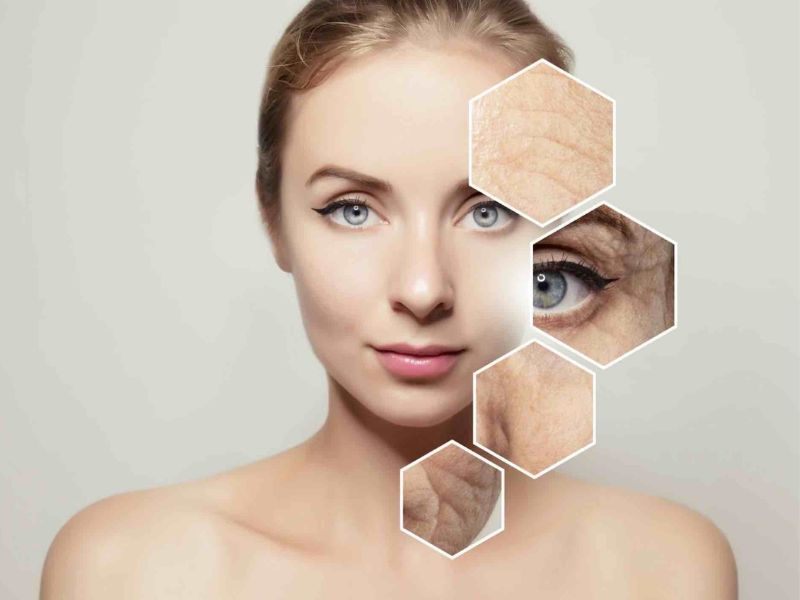 Palmitoylpentapeptide-4 cải thiện rõ rệt tình trạng nếp nhăn