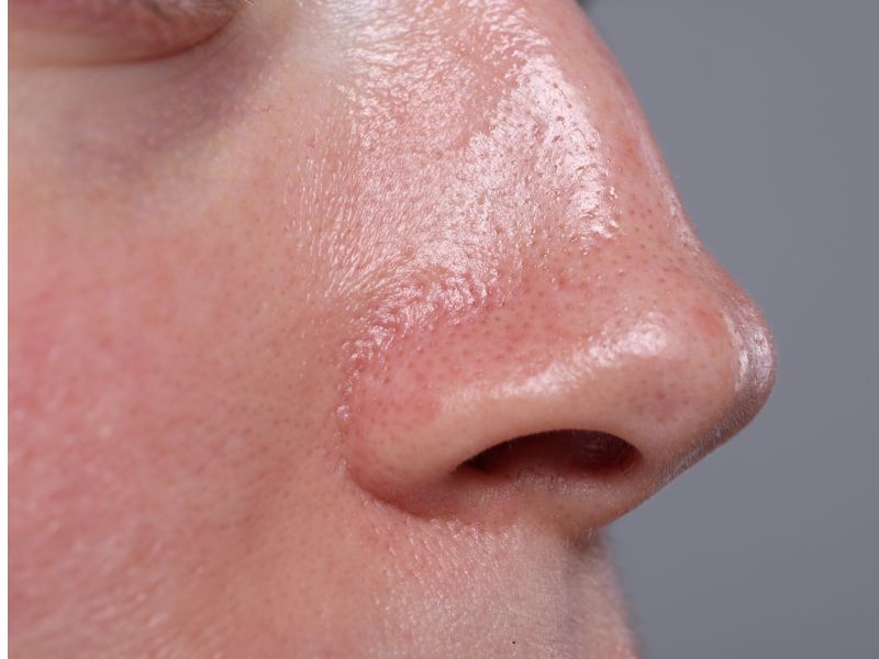 Công dụng làm đẹp của Silica