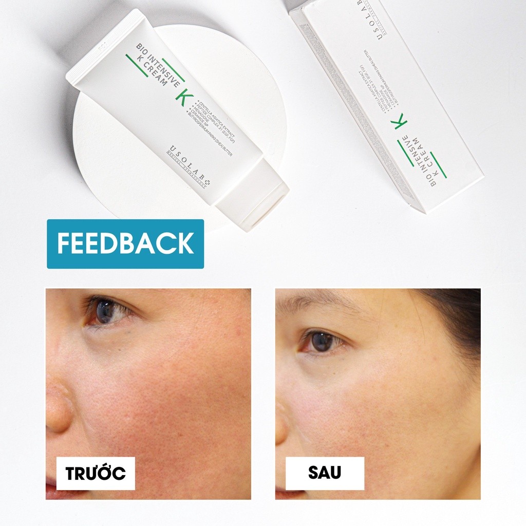 Kem K USOLAB 50ml - Làm Dịu, Phục Hồi Da Nhạy Cảm, Treatment Bio Intensive K Cream - Ảnh 5