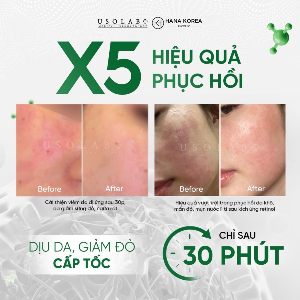 Xịt Khoáng Toner USOLAB 150ml Dịu Da, Phục Hồi Da Sau Tổn Thương Bio Intensive Barrier K Mist - Ảnh 6