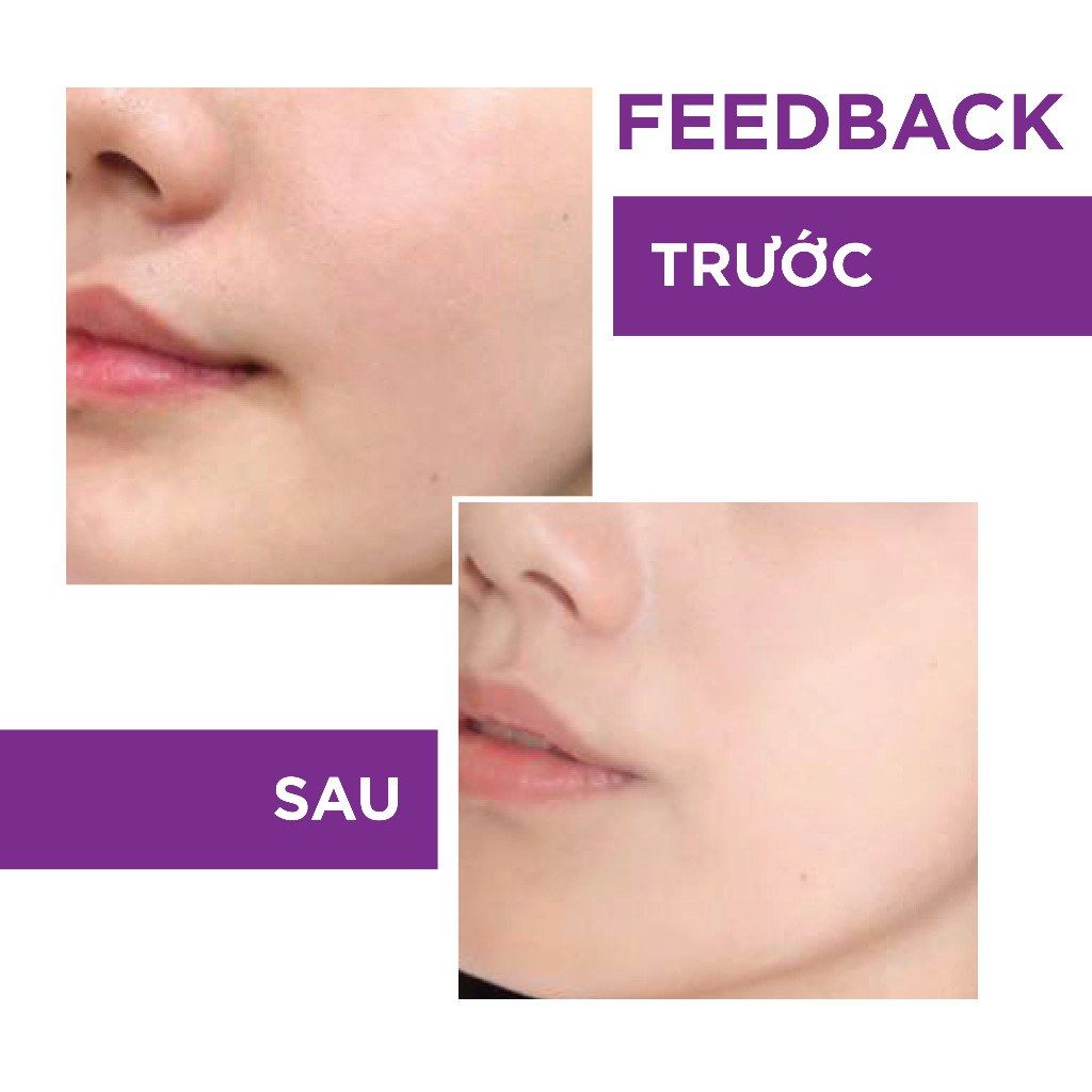 Xịt Khoáng Toner HA B5 ABO 100ml Cấp Ẩm, Phục Hồi Da Active B5 Hyaluron Toner Mist - Hyaluronic Acid & Vitamin B5 - Ảnh 2