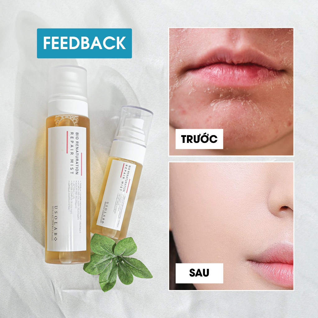Xịt Khoáng Toner USOLAB 150ml Phục Hồi Da Chống Lão Hóa - Bio Renaturation Repair Mist - Ảnh 2